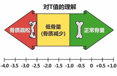 骨里乾坤：揭秘骨密度与生活质量的隐形纽带