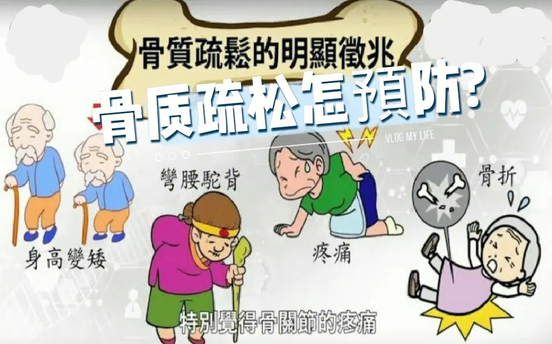 老年人护骨指南：这些小常识帮你呵护骨骼健康