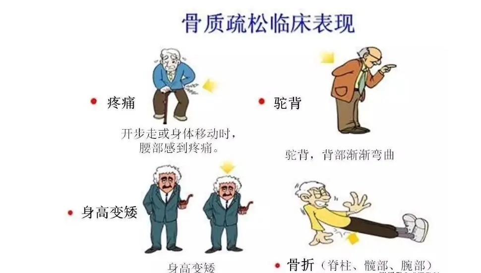 告别 “经验判断”：双能 X 射线如何让骨质疏松诊断更 “量化”？
