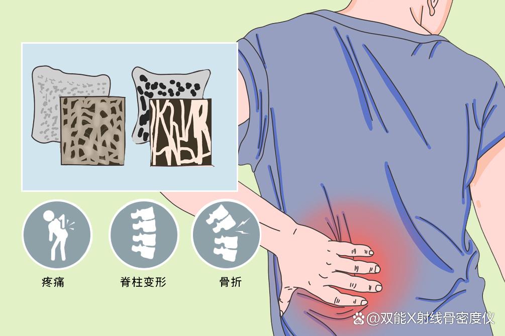 骨头悄悄 “变脆”？身体发出的这些信号，别等疼了才重视