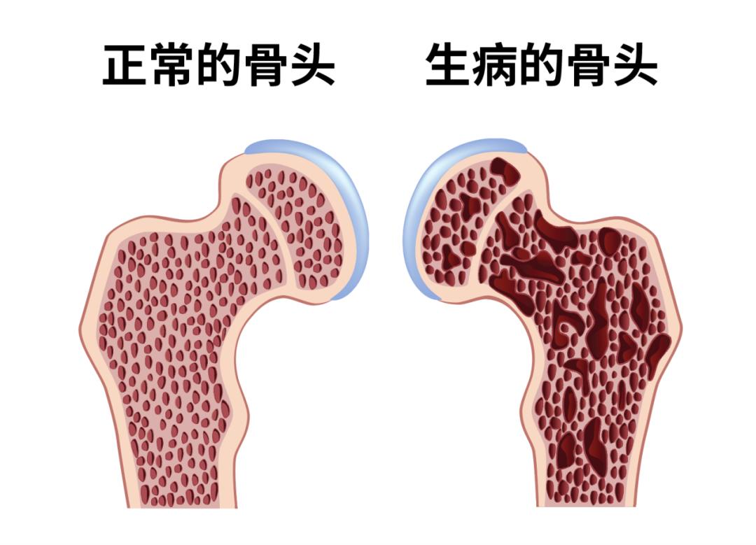 双能 X 射线骨密度仪：一体化创新升级，高效<span style='color:red'><span style='color:red'><span style='color:red'>精准</span></span></span>检测更轻松