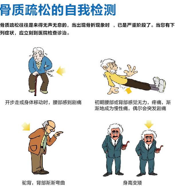 双能 X 射线骨密度仪：一体化创新升级，高效<span style='color:red'><span style='color:red'><span style='color:red'>精准</span></span></span>检测更轻松