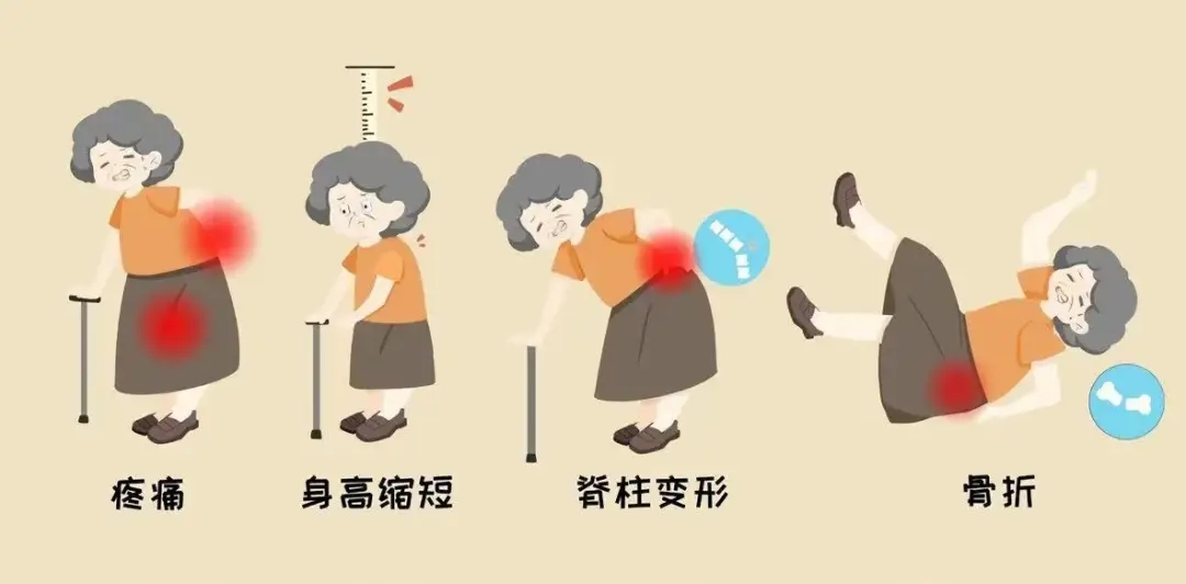 早筛早护防骨折！DXA 双能 X 射线骨密度仪（诊断金标准）的检测与养护指南