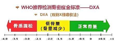 早筛早护防骨折！DXA 双能 X 射线骨密度仪（诊断金标准）的检测与养护指南