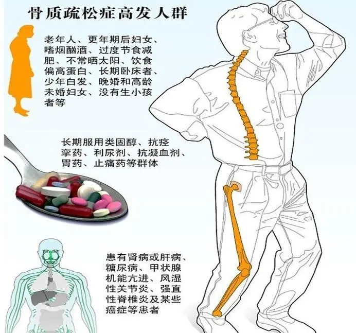 早筛早护防骨折！DXA 双能 X 射线骨密度仪（诊断金标准）的检测与养护指南