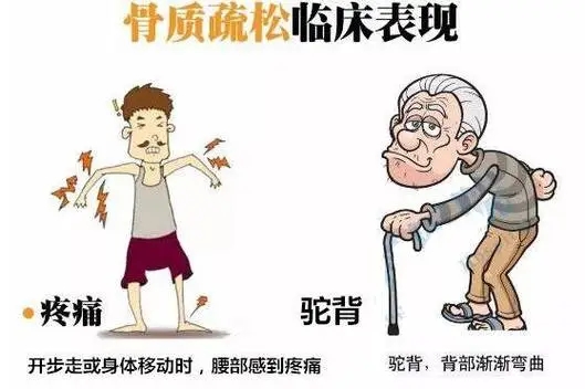 青年养骨、老年护骨，双能 X 射线骨密度仪：不同阶段，同样守护