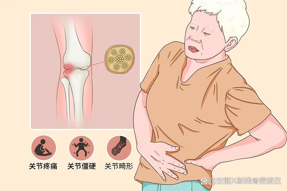 解锁超声骨密度仪的多元应用新场景，重塑骨骼健康管理新模式