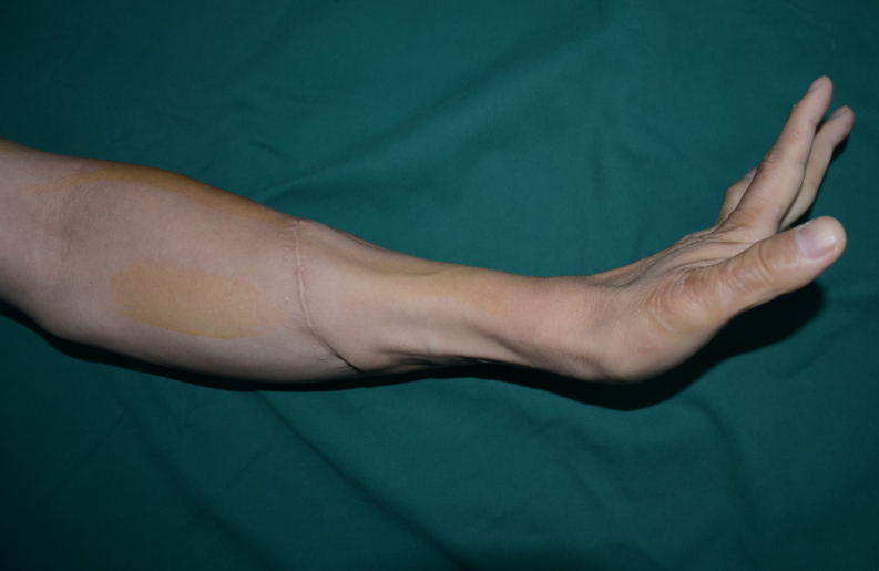 前臂检测适合哪些人群