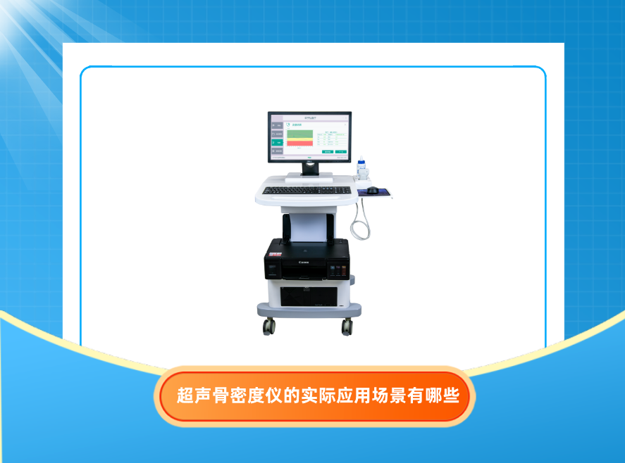 超声骨密度仪的实际应用场景有哪些？